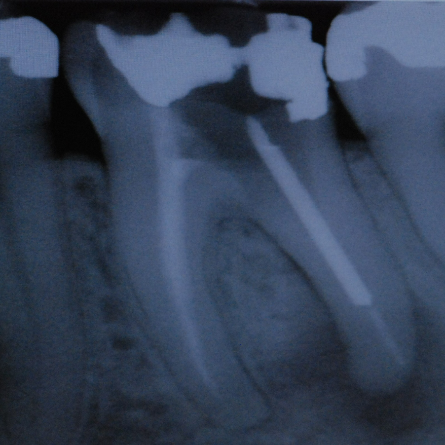 Treatment - Ochilview Dental