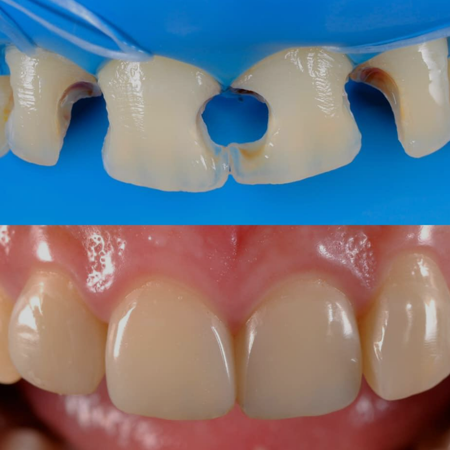 Treatment - Ochilview Dental