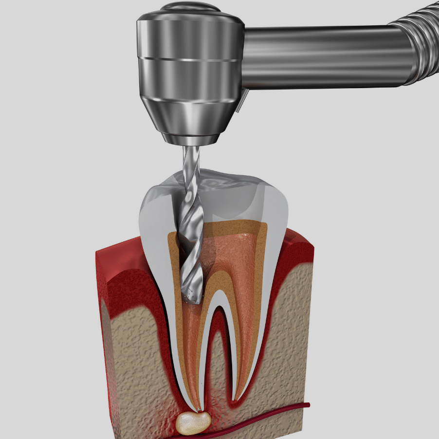 Treatment - Ochilview Dental