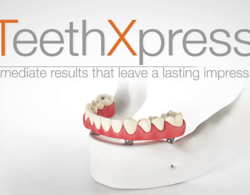 blog - Ochilview Dental