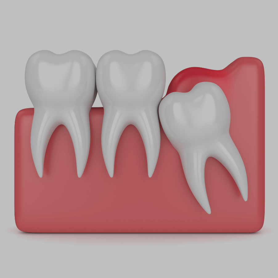 Treatment - Ochilview Dental