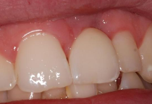 After - Ochilview Dental