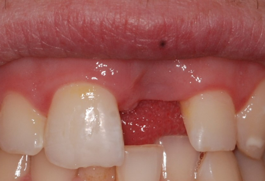 Before - Ochilview Dental