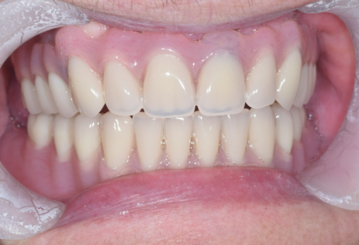 After - Ochilview Dental