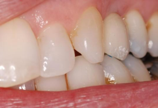 After - Ochilview Dental