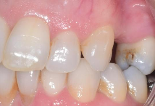 Before - Ochilview Dental