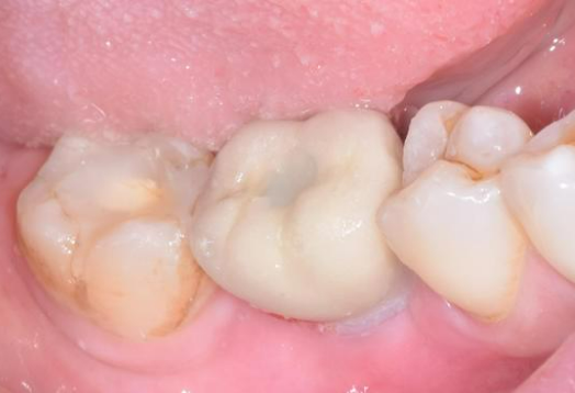 After - Ochilview Dental