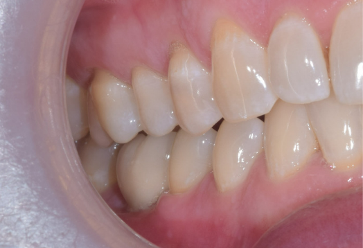 After - Ochilview Dental