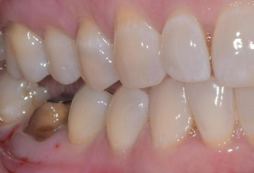 Before - Ochilview Dental