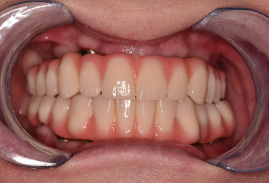 After -Ochilview Dental