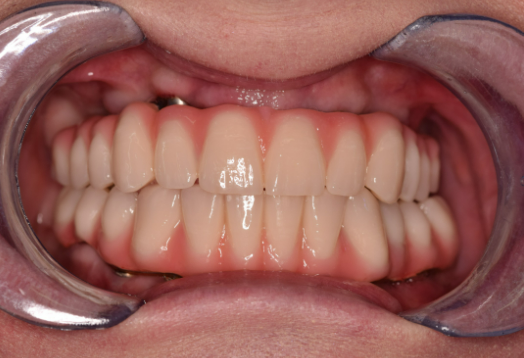 After - Ochilview Dental