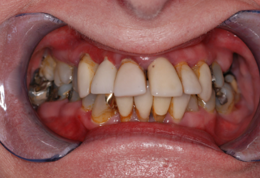 Before - Ochilview Dental