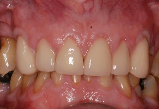 After -Ochilview Dental