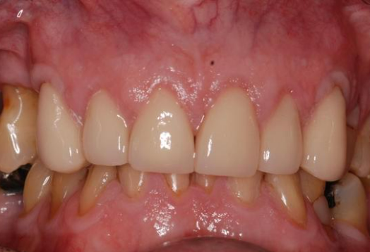 After - Ochilview Dental