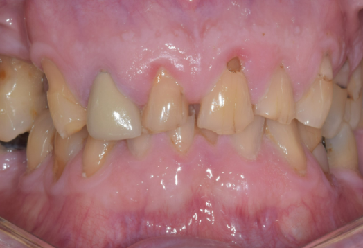 Before - Ochilview Dental