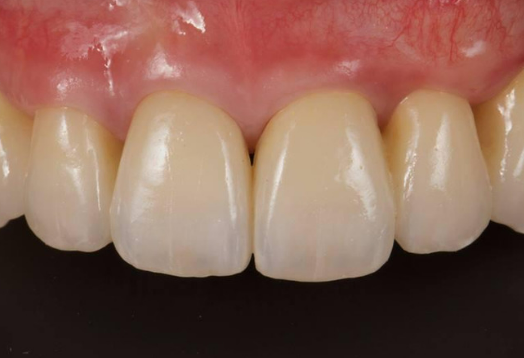 After -Ochilview Dental