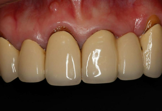 Before - Ochilview Dental