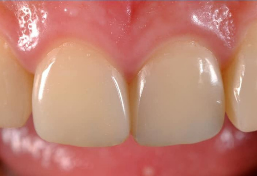 After - Ochilview Dental